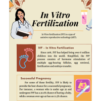 In Vitro Fertilization